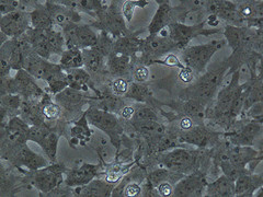 Stem cells, pondering the future